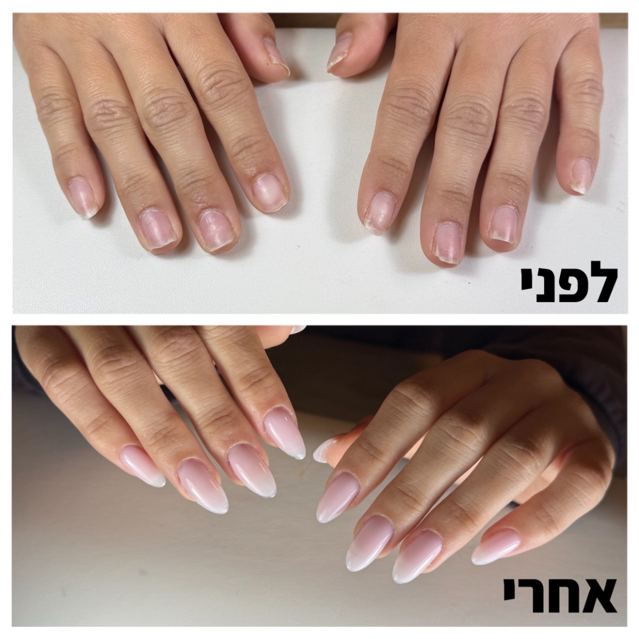 שיקום הציפורניים