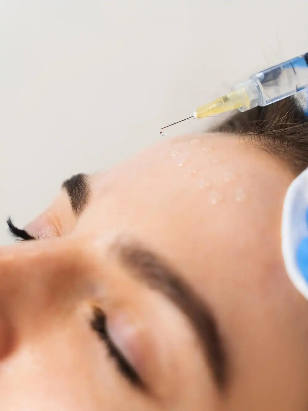 מזותרפיה – חידוש העור