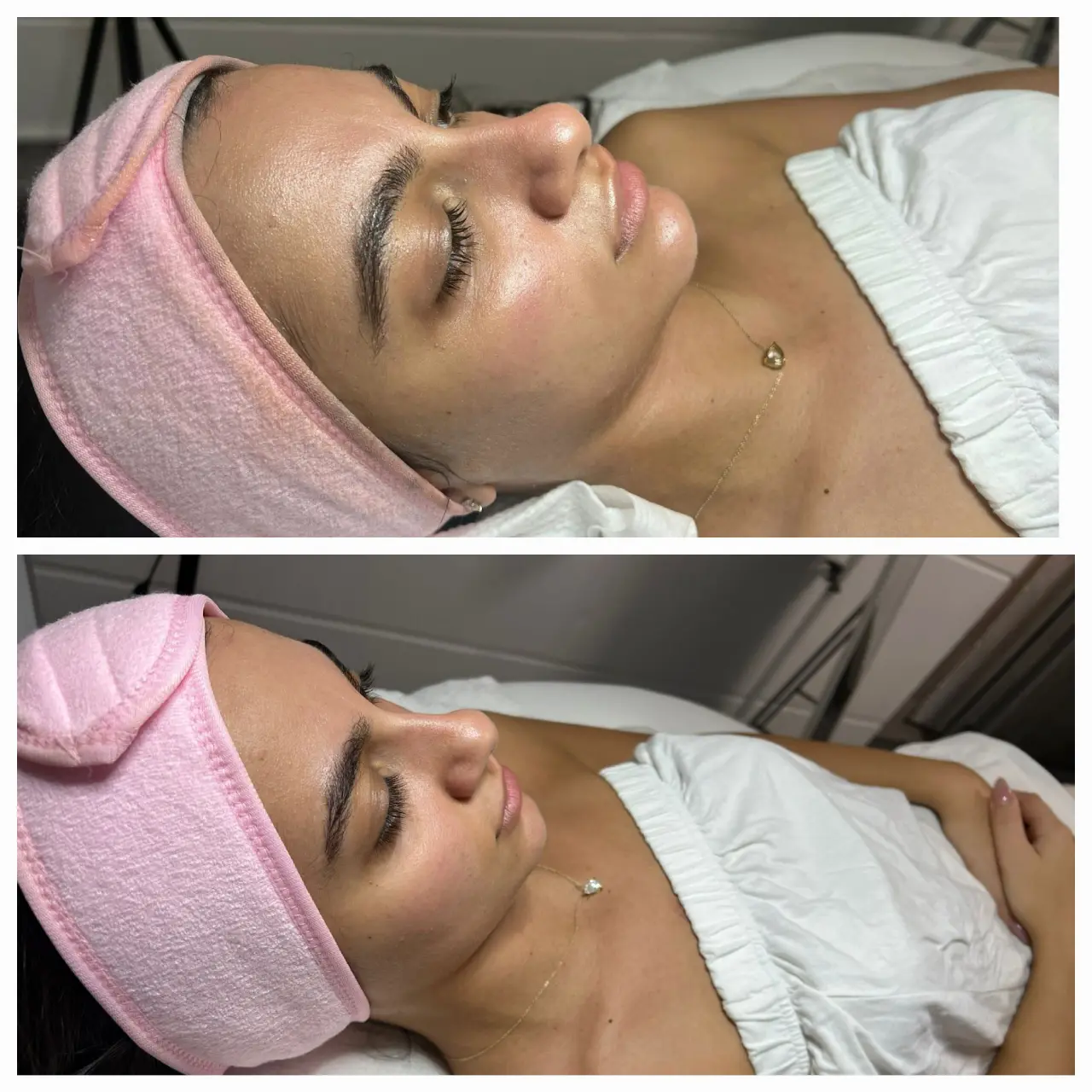  טיפול איזון ויופי לכלה