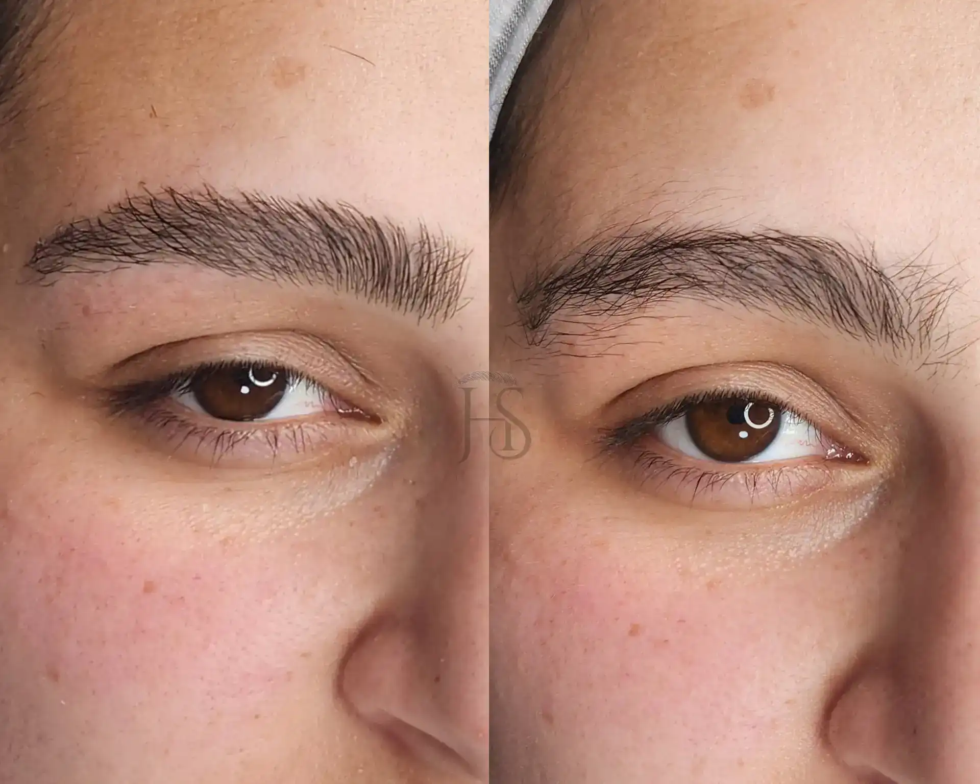 עיצוב ושיקום הגבות