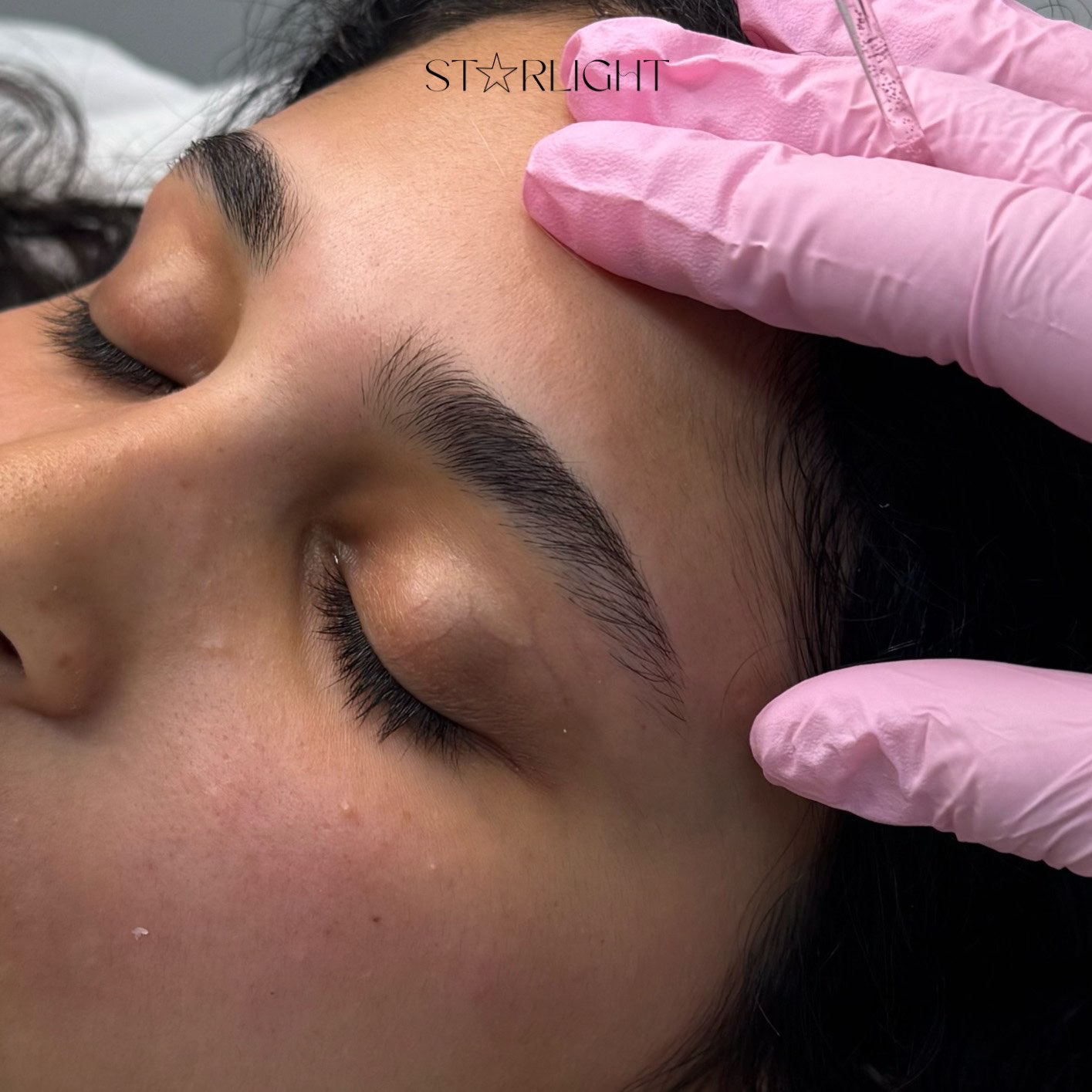 לפני - אחריי 🪄