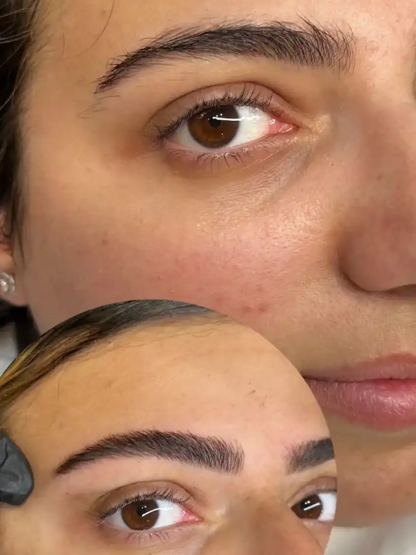 מדריך מלא למיקרובליידינג – כל מה שצריך לדעת