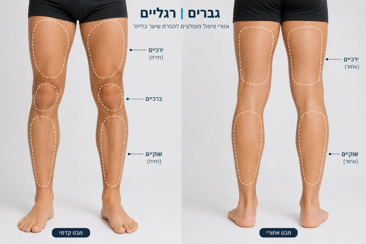 הסרת שיער רגליים מלא 10 טיפולים