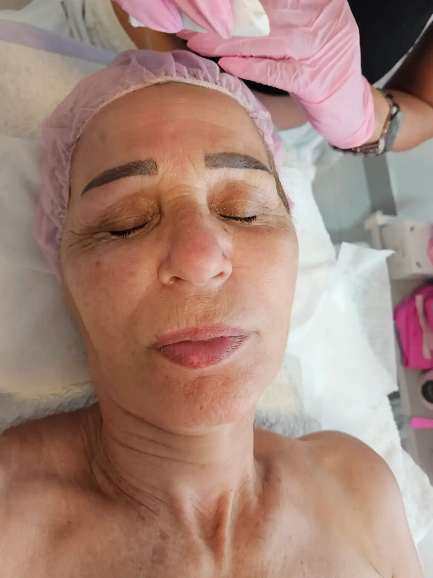 טיפול פנים יופי וזוהר