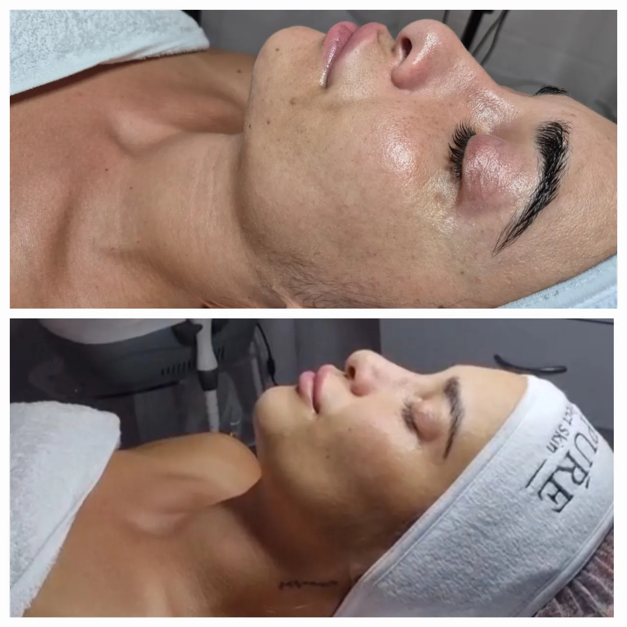 טיפול פנים קלאסי