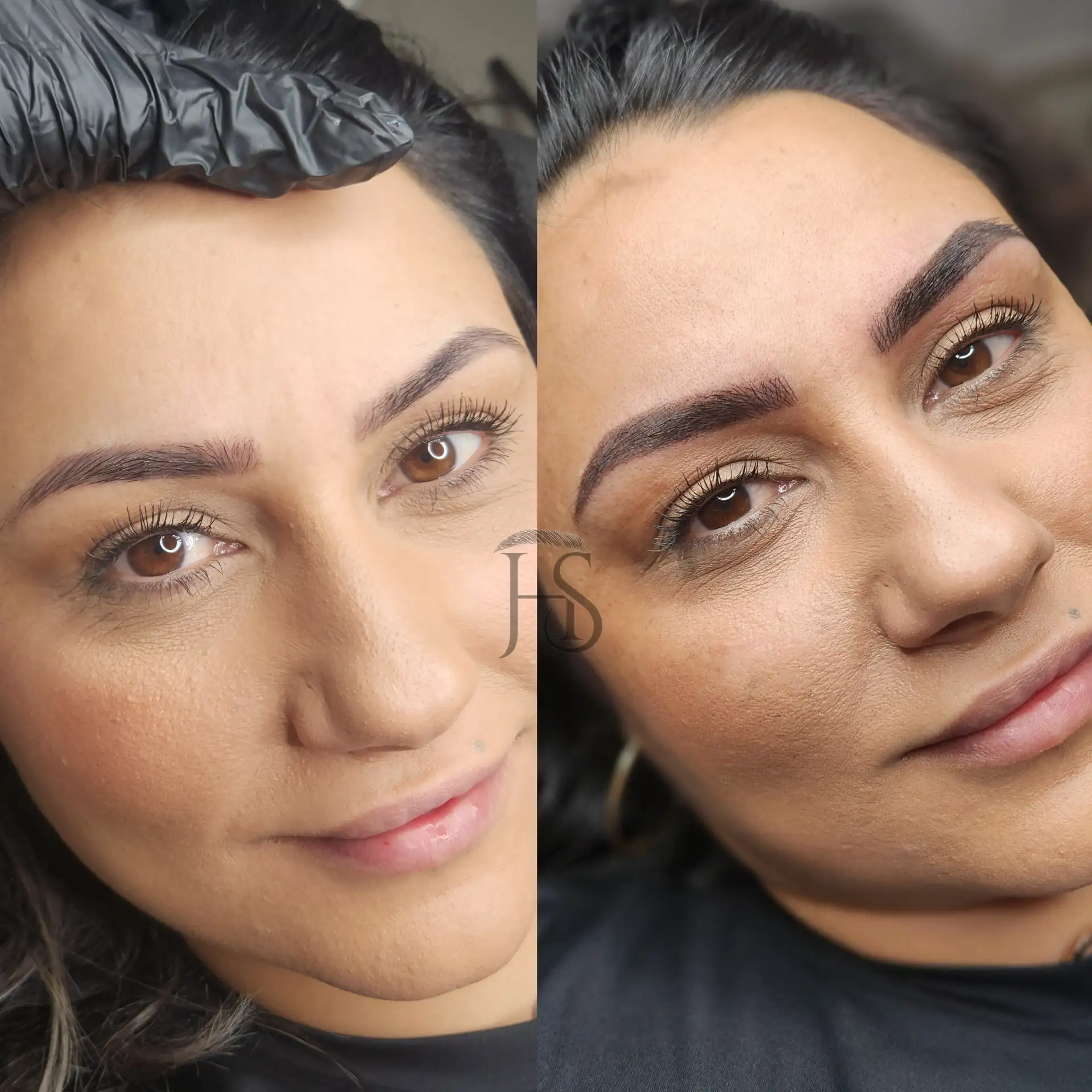 טיפול משולב