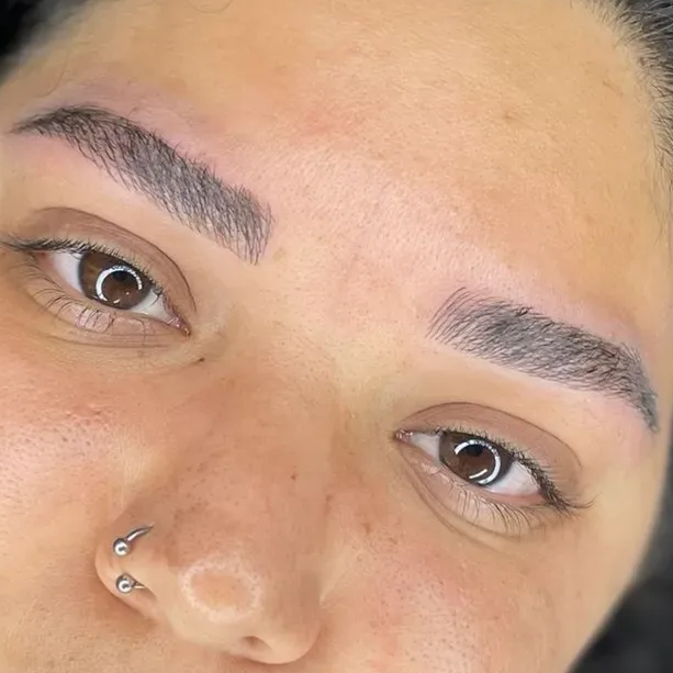 מיקרובליידינג