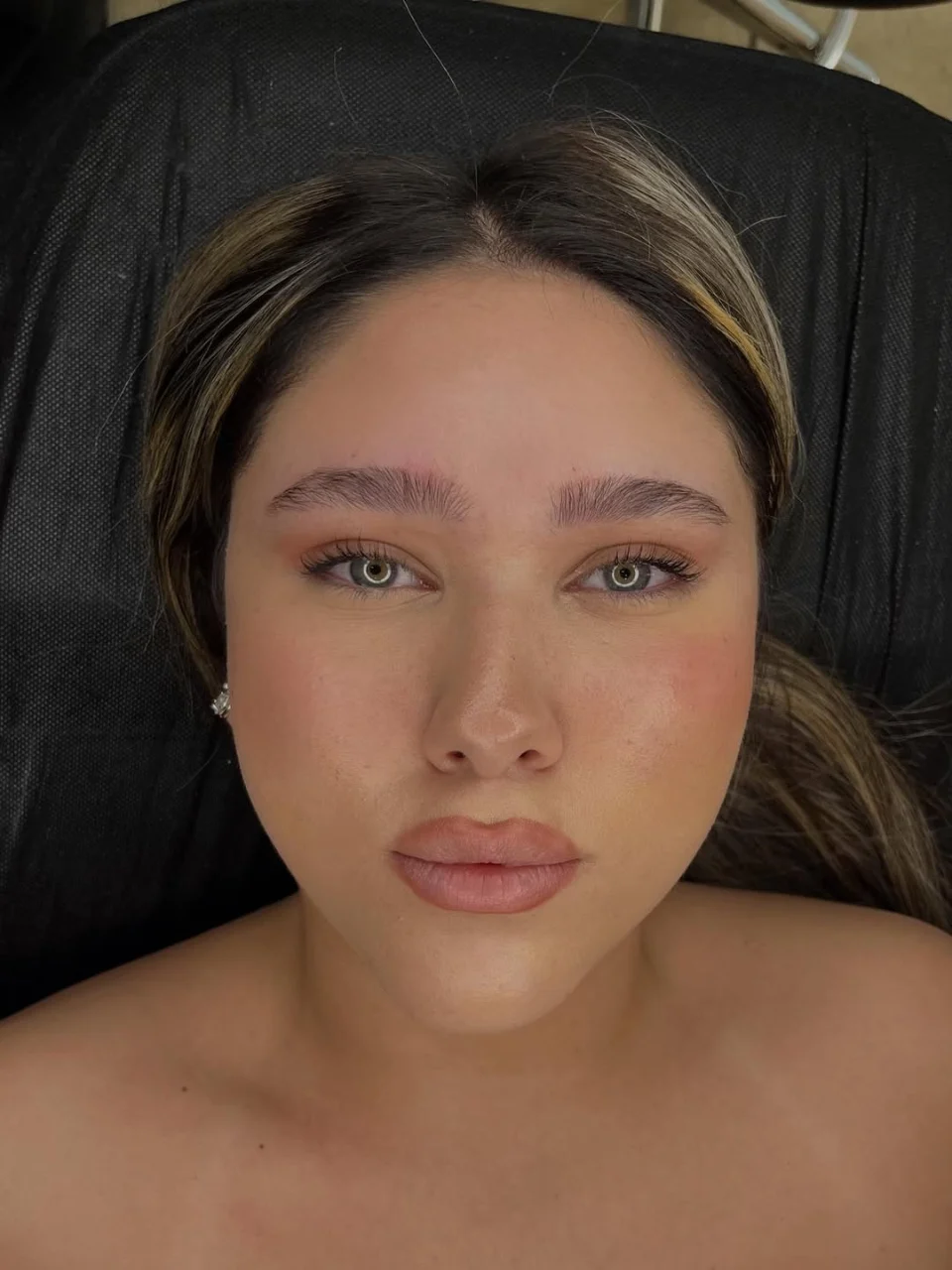 מיקרובליידינג