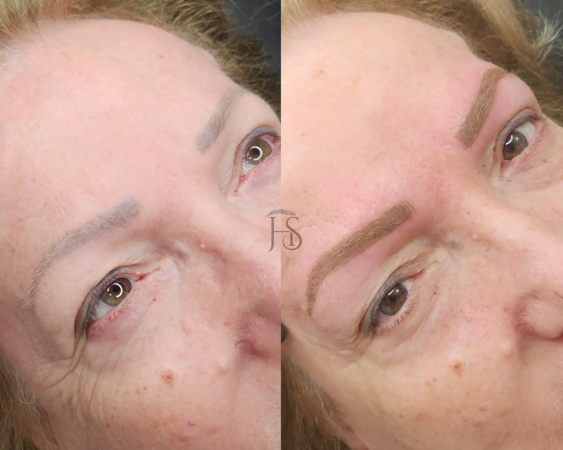 טיפול משולב