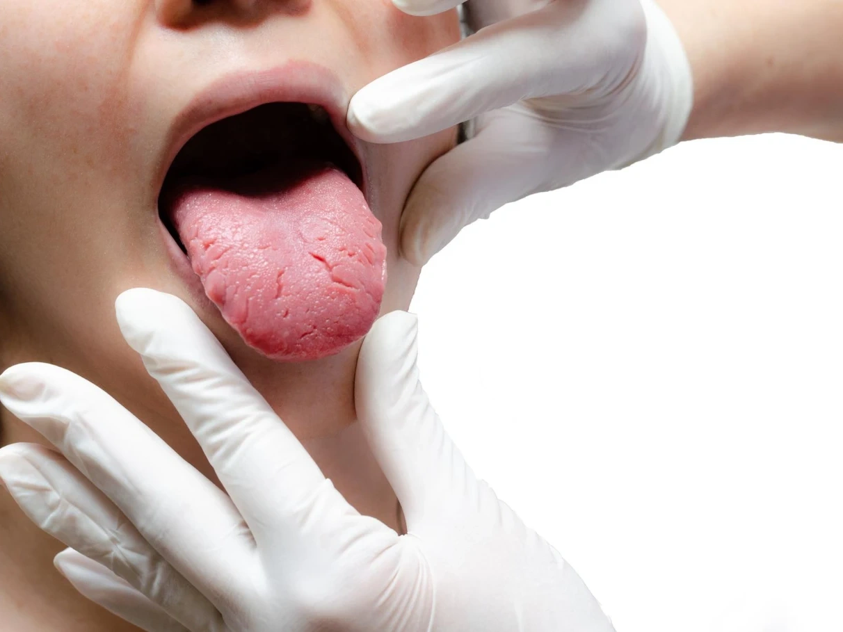 אבחון בריאותי ייחודי ומעמיק המבוצע באמצעות צילום הלשון.