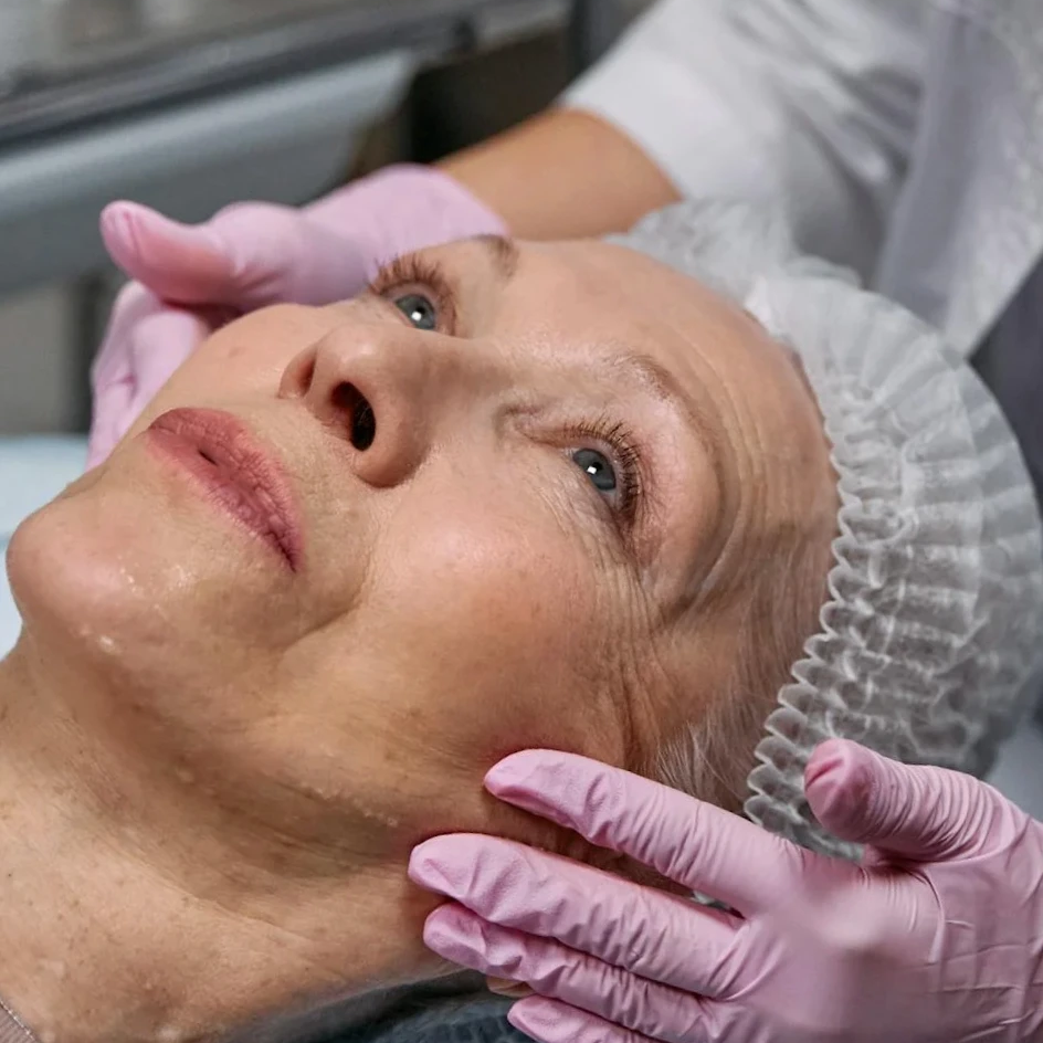 פלזמה פן  || מהפכה בחידוש העור