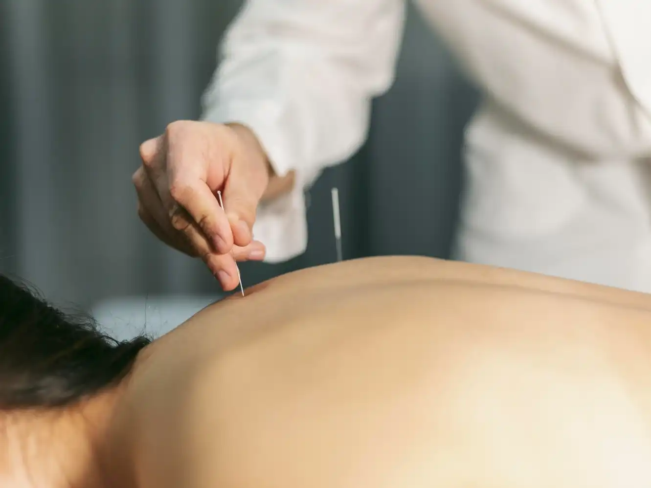 טיפול ברפואה סינית-יפנית