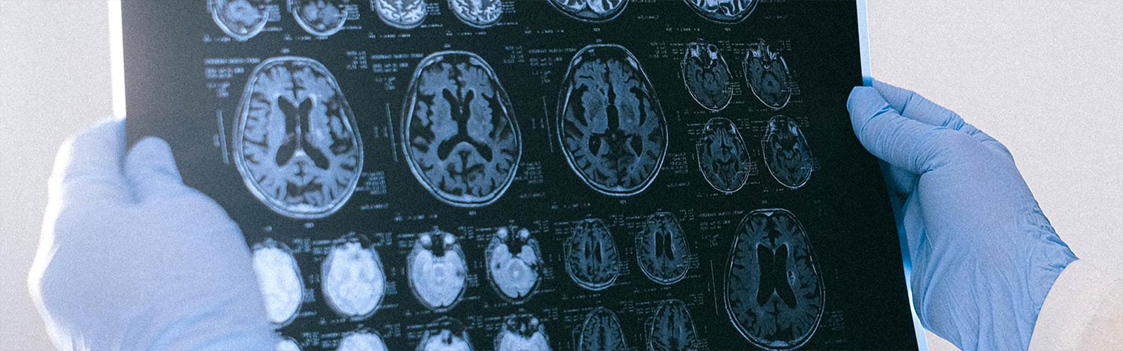 A medical professional wearing blue gloves holds up a scan showing multiple MRI images of the human brain for examination.