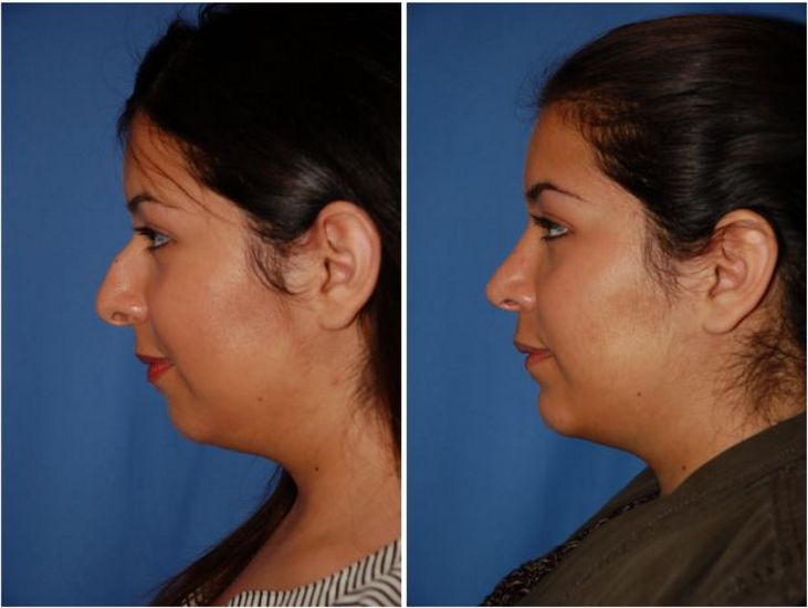 facial plastic surgery Portland Oregon