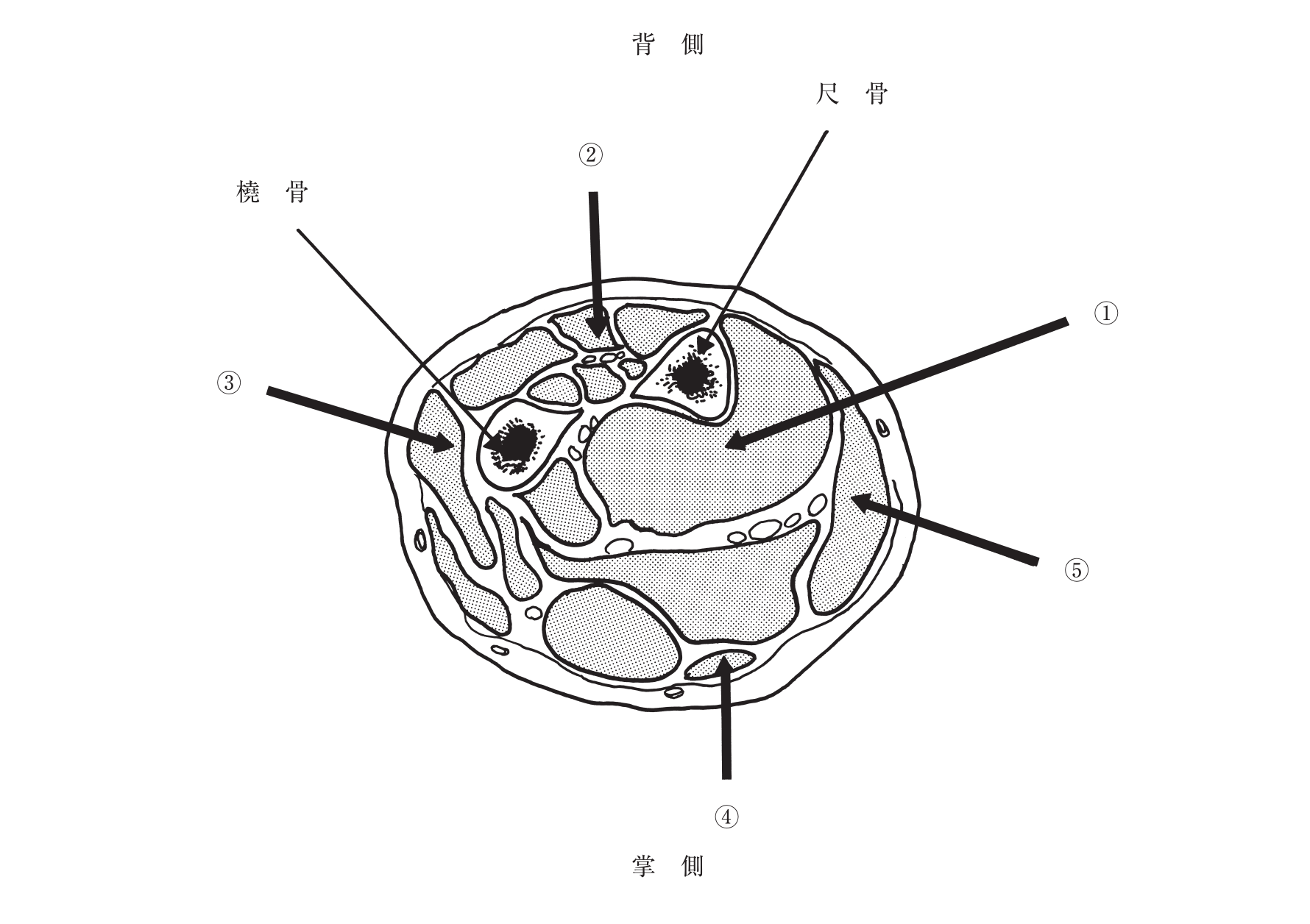 2017年度 問105 の図 1