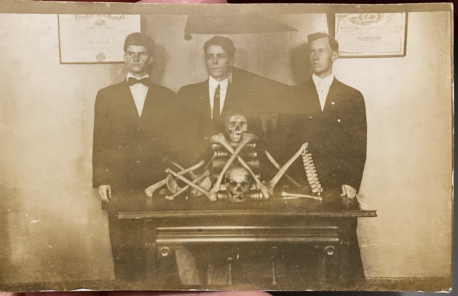 Fraternal Medical Dissection Skulls Bones Skeletons Cadaver Real Photo Postcard