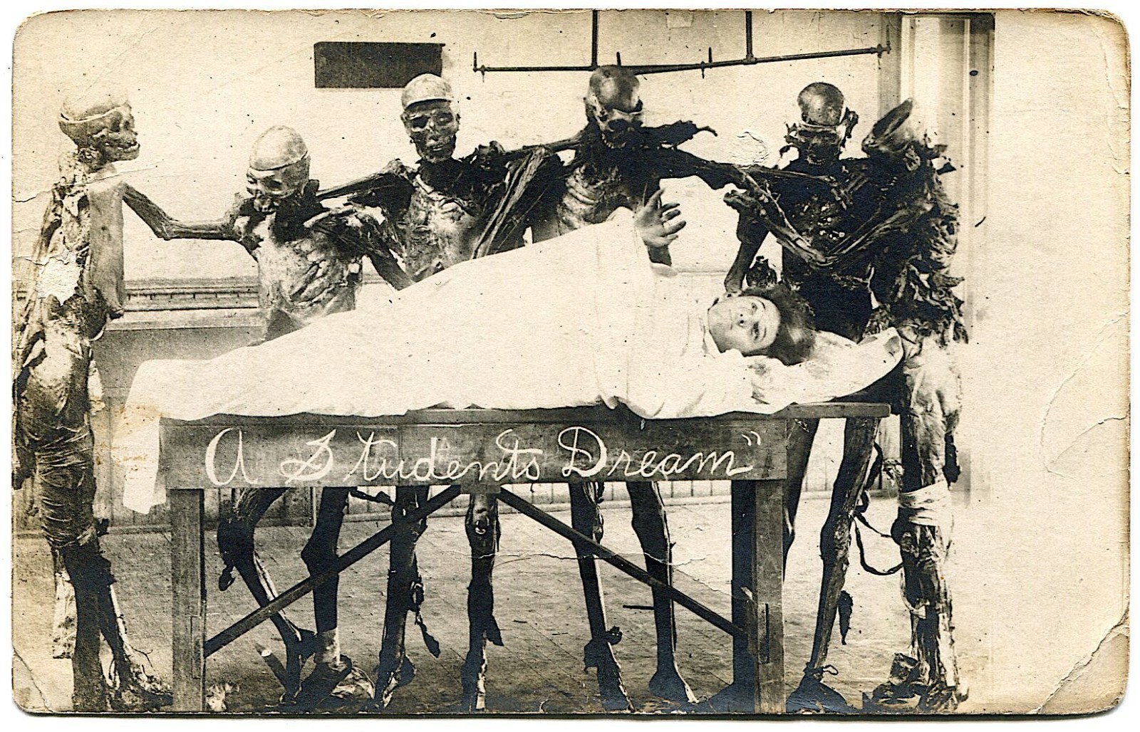 Cadavers Skeletons Operate on Student Post Mortem Real Photo Postcard