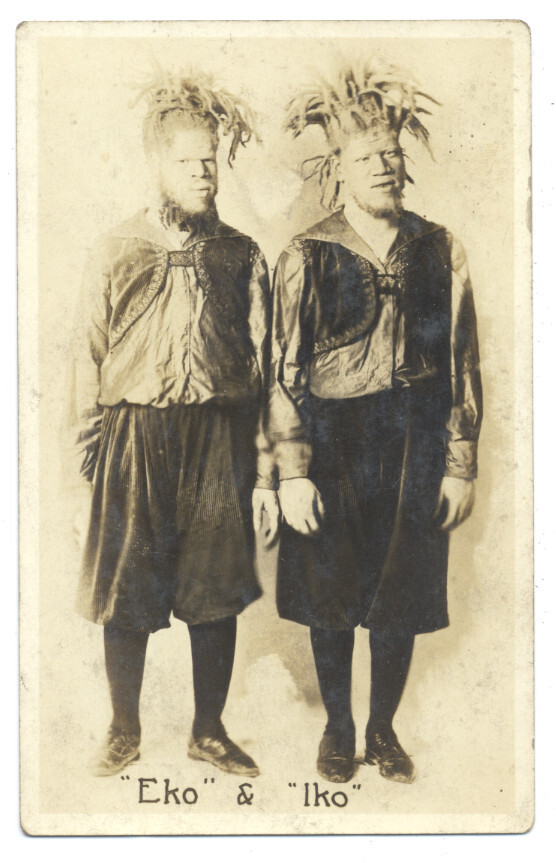 Eko and Iko Black Albino Circus Sideshow Freaks Cannibals Aliens Real Photo Postcard