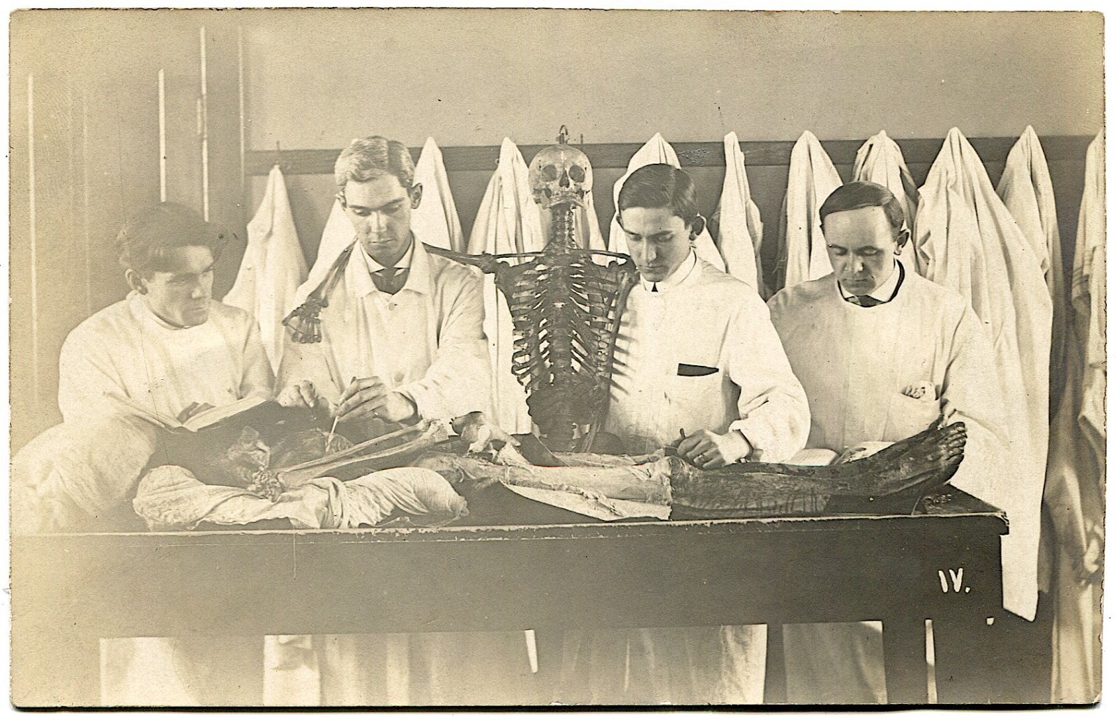 Medical Students with Skeleton Dissecting a Cadaver Macabre Humor 1910s Real Photo Postcard