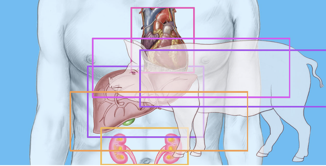 Kidneys Don’t See Color