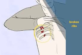 Meaning of banking in commerce