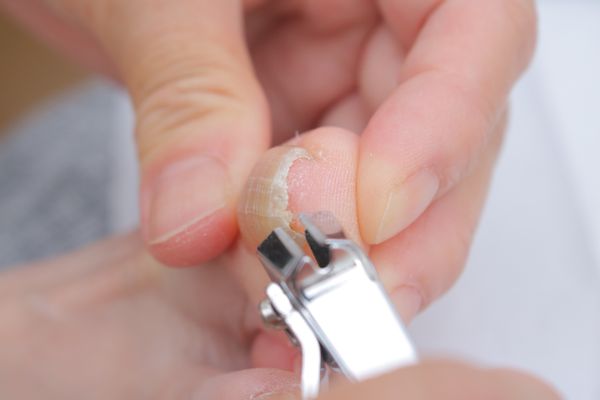 巻き爪用爪切りのおすすめ16品。カーブ刃/日本製/ニッパーなどあなたのネイルケアアイテムを紹介の画像