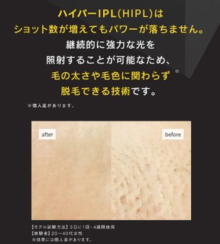 JOVS Doraの画像 3枚目