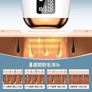 IPL光脱毛機の画像 3枚目