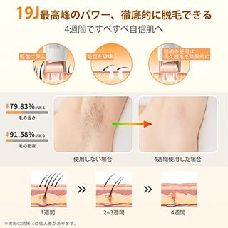 家庭用脱毛器の画像 3枚目