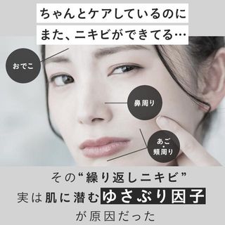 アクネケア 化粧液＜医薬部外品＞の画像 3枚目