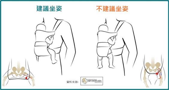 安琪 安琪Beco雙子星寶寶背巾