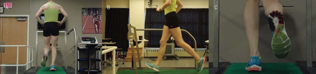 runners knee causes and treatment the prehab guys