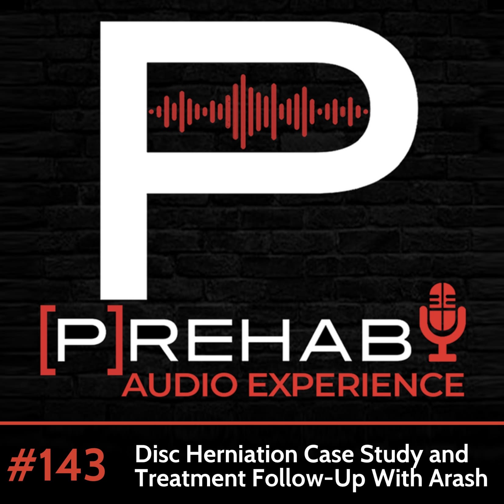 Disc Herniation Case Study: Treatment Follow Up With Arash
