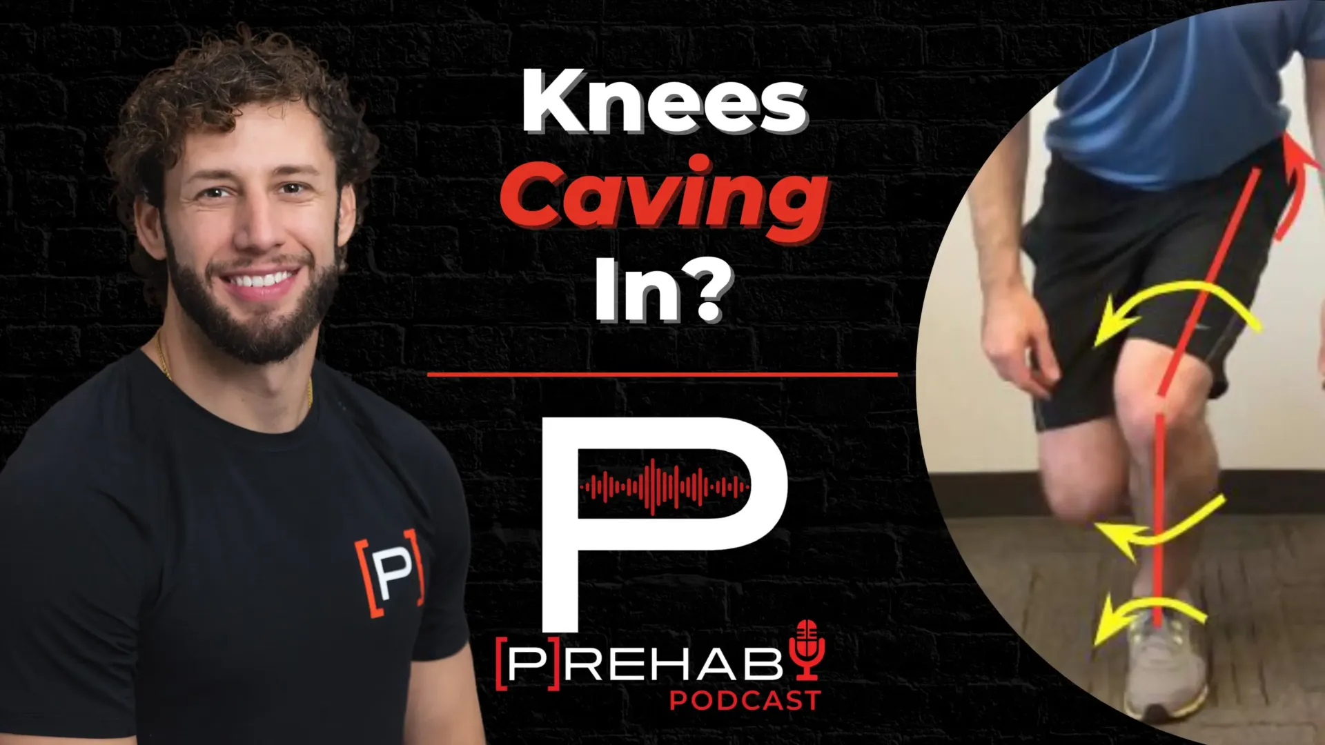 Why Your Knees Cave In? Is It Time To Stop Blaming The Glute Med For Dynamic Knee Valgus?