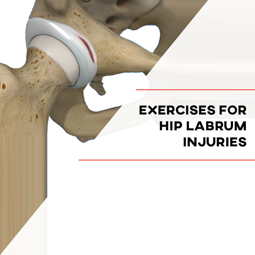 Exercises for Hip Labrum Injuries-IG