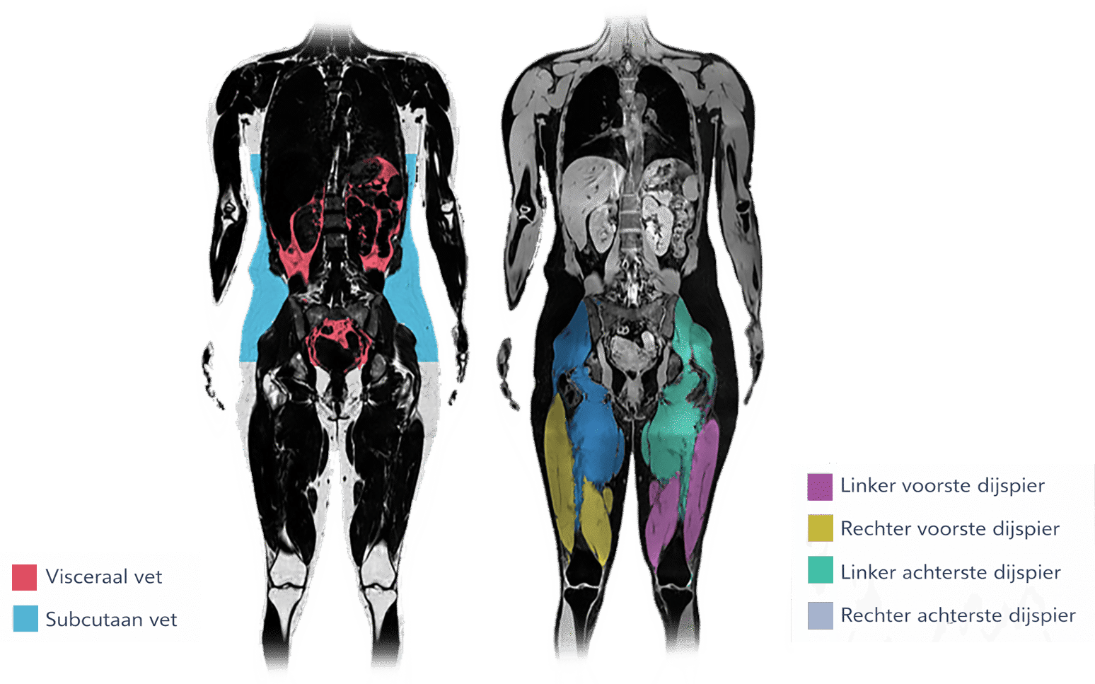 Body composition legenda nl