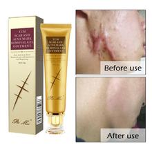 TCM Scar and Acne Marks Removal Gel, Scars, Burns, Stretch Marks, Acne Spots, Treatment Gel Ointment for Face and Body 30g