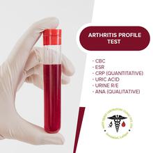 Arthritis Profile Test