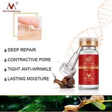 High Quality Snail 100% Pure Plant Extract Hyaluronic Acid