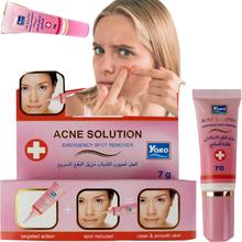 YOKO Acne Solution Emergency Spot Remover Clear & Smooth Skin-7 gm