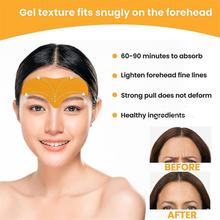 10 Patches Forehead Line Removal Gel Patch Anti Wrinkle Forehead Firming Mask Frown Lines Treatment Stickers Anti-Aging Lifting Skin Care