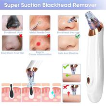 CHINA SALE-   Blackhead Remover Skin Care Tool Face for Deep