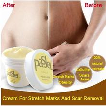 Hamile Maternidad Pasjel Cream For Stretch Marks And Scar