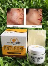 Show Naii Anti Acne 10 ml 