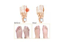 Toe Separator Spreader Eases Foot Pain Foot Hallux Vagus Correction Guard Cushion Concealer Thumb-1 Pair