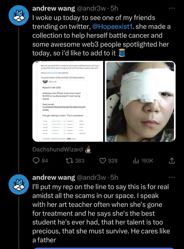 Tweets by Andrew Wang: "I woke up today to see one of my friends trending on twitter, @Hopeexist1. she made a collection to help herself battle cancer and some awesome web3 people spotlighted her today, so i'd like to add to it  I'll put my rep on the line to say this is for real amidst all the scams in our space. I speak with her art teacher often when she's gone for treatment and he says she's the best student he's ever had, that her talent is too precious, that she must survive. He cares like a father"