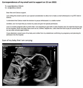 Correspondences of my email sent to support on 15 Jun 2022:  To: support@celsius.network Cc: ceo@celsius.network  Dear Alex and Celcius support, I am writing this email to ask for your special consideration to allow me to make a small withdrawal on my BTC held in Celcius. I understand that Celsius made the decision to pause withdrawals in a volatile market condition, but do hope that you review my case and give me special permission.  I am 5.5 months pregnant with my third child. I am expecting to give birth in early October and I do need the fund to pay for the hospital, doctor and baby items such as cot, clothes, nappies etc. I also need the fund to pay for school fees for my two other schools aged children.  I have attached a recent scan of my baby and a letter from my obstetrician confirming my pregnancy and planning for admission into the hospital.  Scan of my baby that am carrying: [ultrasound photo of a fetus]