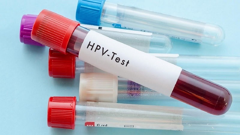 What Is Hpv Testing How To Read Test Results 3402
