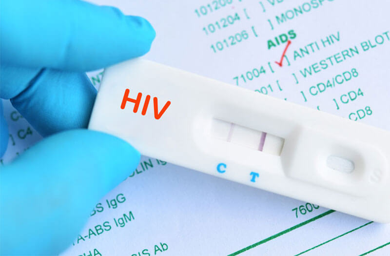 When Is The Most Accurate Hiv Test 8176