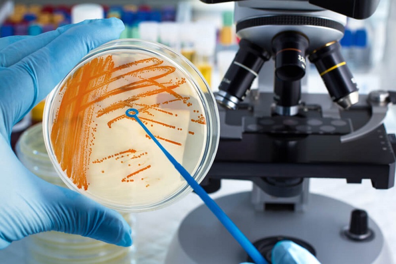 what-is-the-purpose-of-microbiological-testing-what-types-of-tests-are